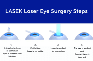 LASEK, LASEK Laser Surgery, LASEK Laser Eye Surgery