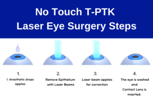 No Touch laser eye surgery, T-PRK Laser eye surgery, Transepithelial PRK Laser Eye surgery, Transepithelial PRK, T-PRK, No Touch, No-Touch