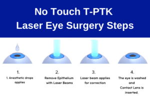 The Eye Chart - VIP Laser Eye Center