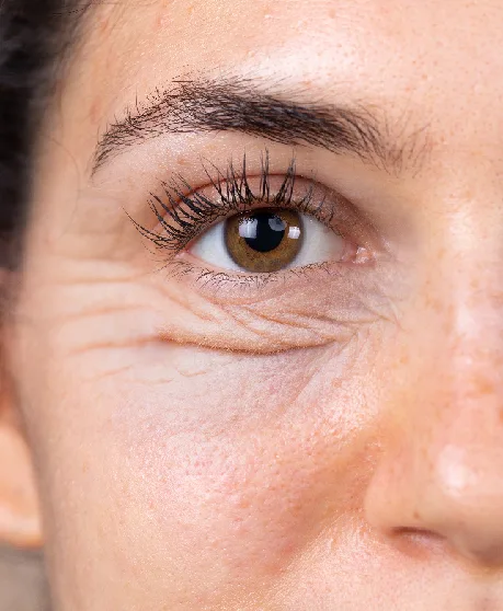 Bleforaplasti, Chirurgie des yeux d'amande, Blépharoplastie Chirurgie des paupières, Retrait du sac des paupières, Laser Eye Lid