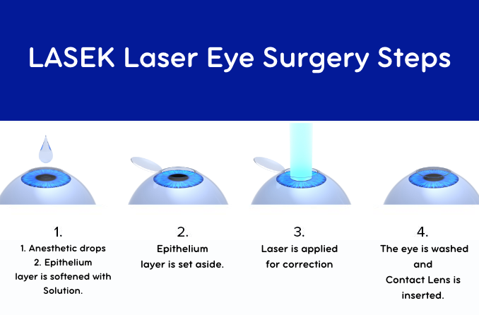 LASEK Laser Eye Surgery - Smart Laser Eye Center